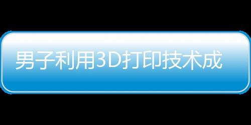 男子利用3D打印技术成功为舅舅接上断指