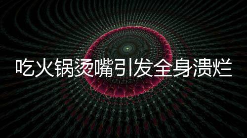 吃火锅烫嘴引发全身溃烂，警醒！火锅美食背后的健康隐患