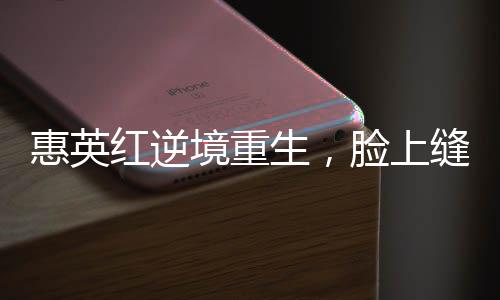 惠英红逆境重生，脸上缝了89针的坚韧故事