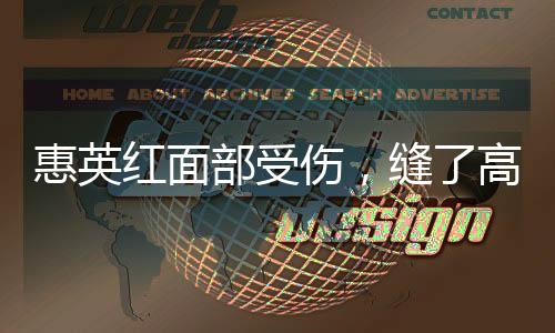 惠英红面部受伤，缝了高达89针——深度解析其事故与现状
