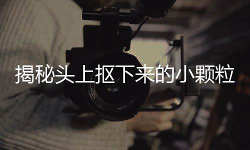 揭秘头上抠下来的小颗粒，它们究竟是何物？