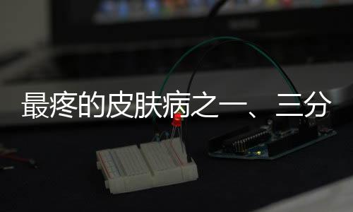 最疼的皮肤病之一、三分之一人群面临挑战