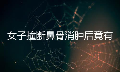 女子撞断鼻骨消肿后竟有高鼻梁，奇妙经历揭示医学魅力