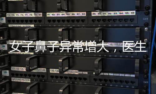 女子鼻子异常增大，医生迅速察觉不寻常现象