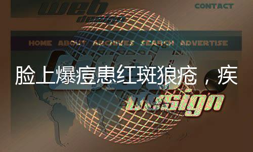 脸上爆痘患红斑狼疮，疾病解析与应对之道