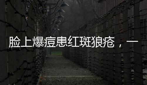 脸上爆痘患红斑狼疮，一位患者的深度解析与自我反思