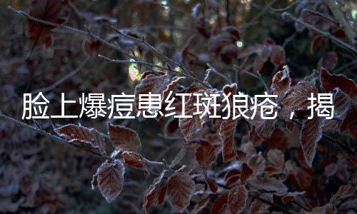 脸上爆痘患红斑狼疮，揭示病症真相与健康应对之道