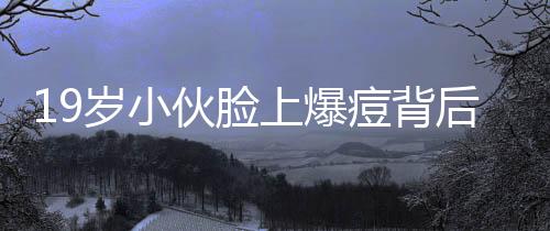 19岁小伙脸上爆痘背后隐藏红斑狼疮真相揭秘
